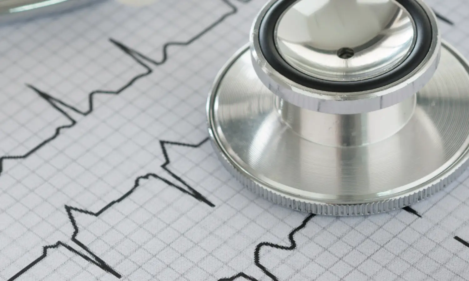 Electrocardiografía